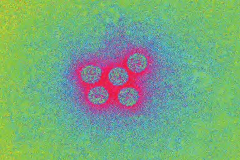 A rendering of the polio virus on a molecular level.