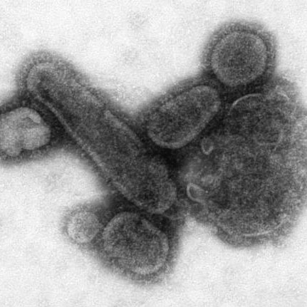 Image of influenza virus